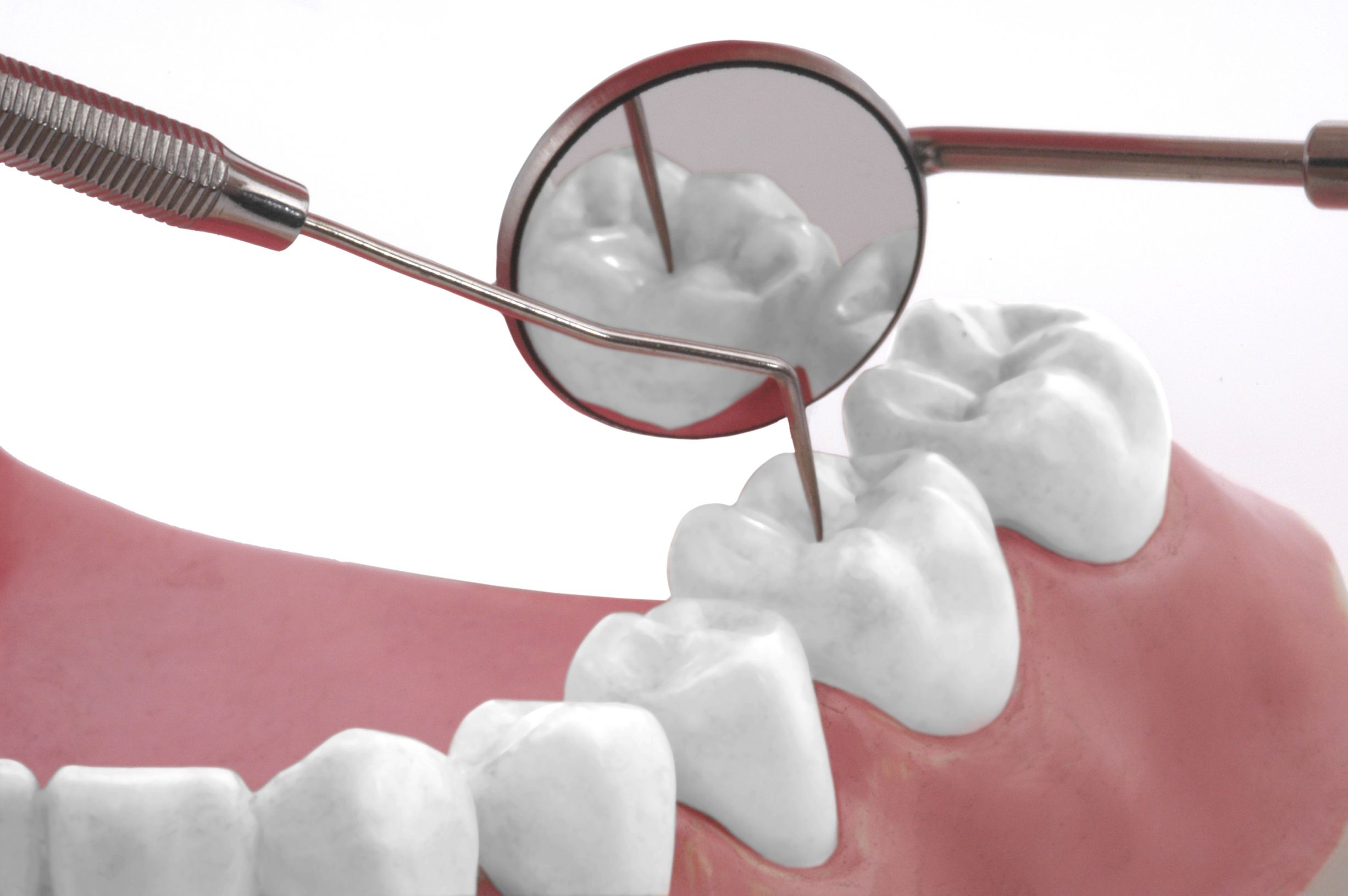 Transform Your Smile with Expertly Crafted Dentures and Dental Services Near Port Townsend, WA, for Comfort and Confidence