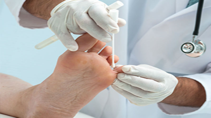 Tips for Finding a Quality Podiatric Surgeon in Racine WI