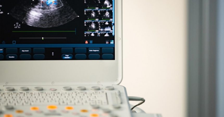 Purchase a Sonosite Ultrasound Machine From a Trusted and Reliable Company