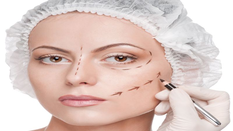 What You Need to Know When Considering a Thread Lift in Chicago