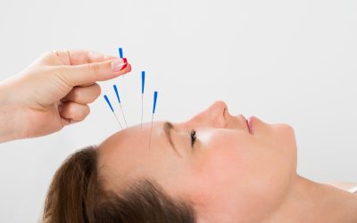 Discover Holistic Wellness and Rejuvenation at an Acupuncture Clinic in Burbank, CA